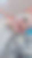 صورة العضو