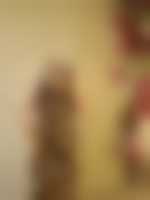 صورة العضو