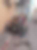 صورة العضو
